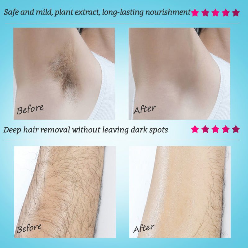 RtopR Mango Depilatory Cream