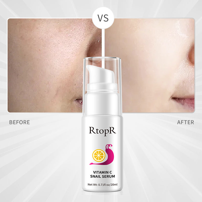 RtopR Vitamin C Snail Serum