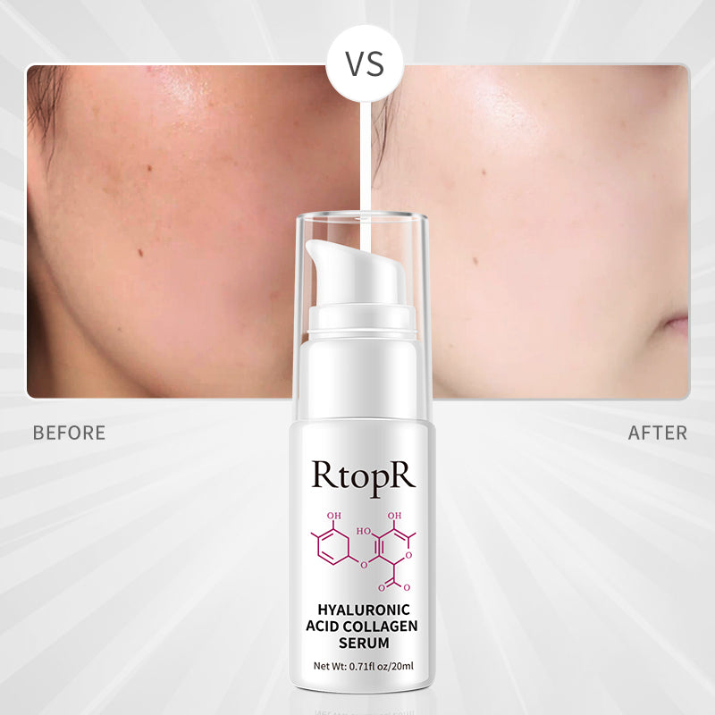RtopR Hyaluronic Acid Collagen Serum