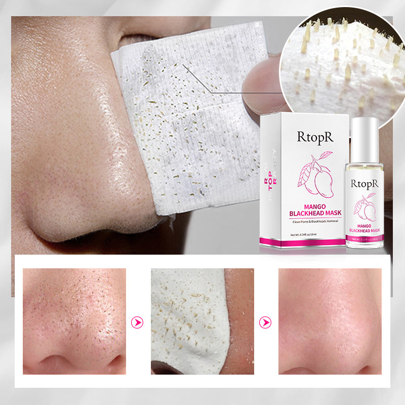 RtopR Mango Blackhead Mask