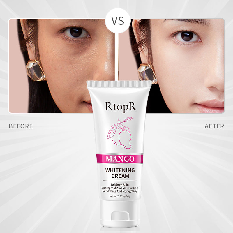 RtopR Mango Whitening Cream