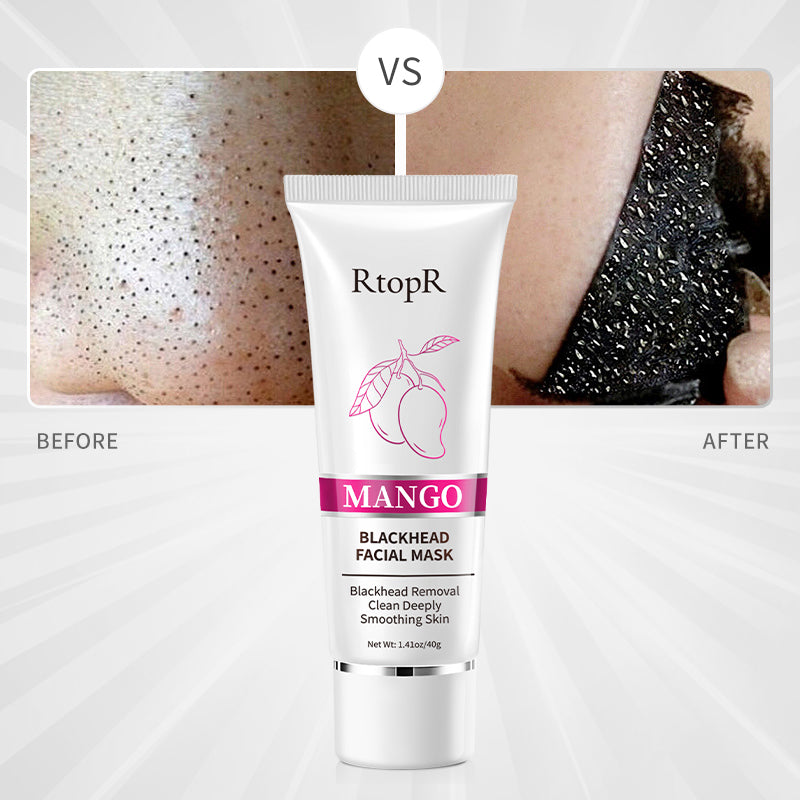 RtopR Mango Blackhead Facial Mask