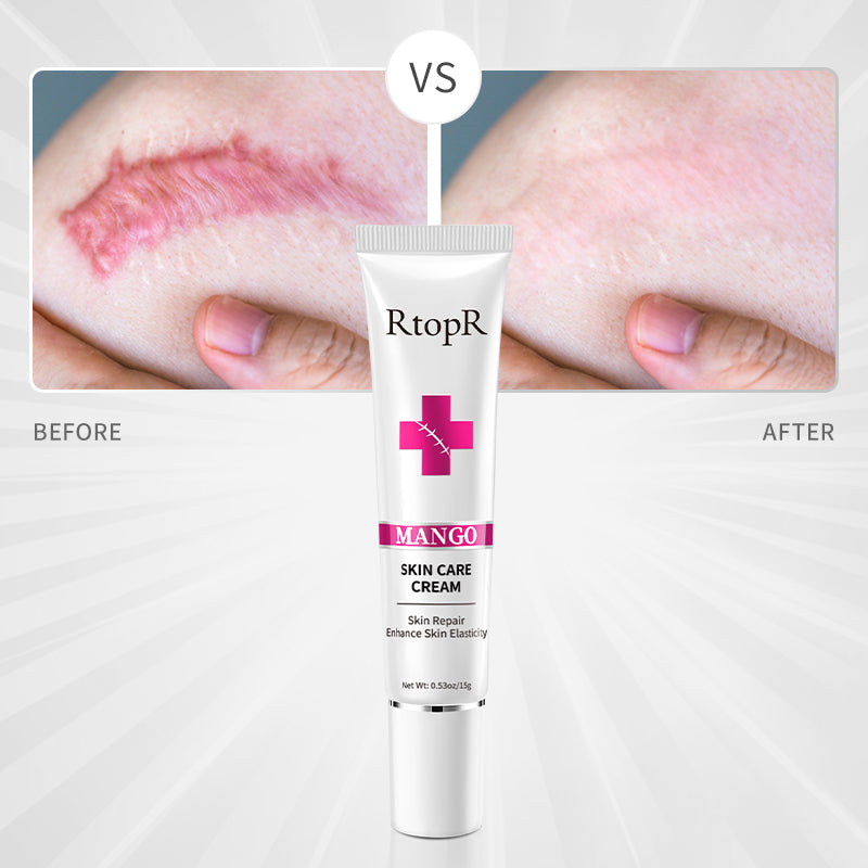 RtopR Mango Skin Care Cream