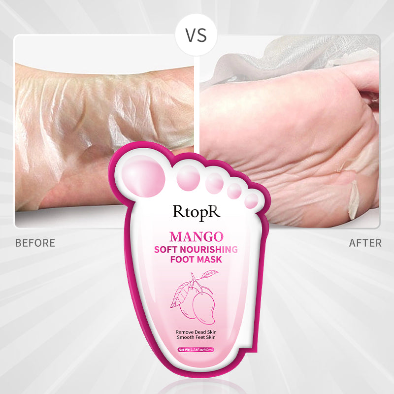 RtopR Mango Soft Nourishing Foot Mask