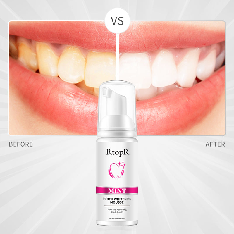 RtopR Mint Tooth Whitening Mousse