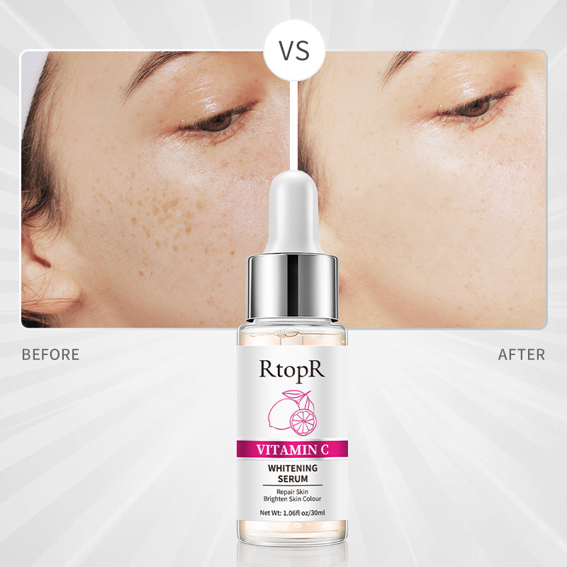 RtopR Vitamin C Whitening Serum